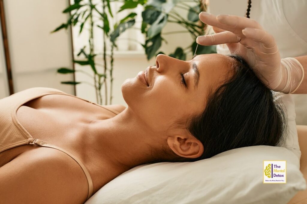 Acupuncture for migraines
